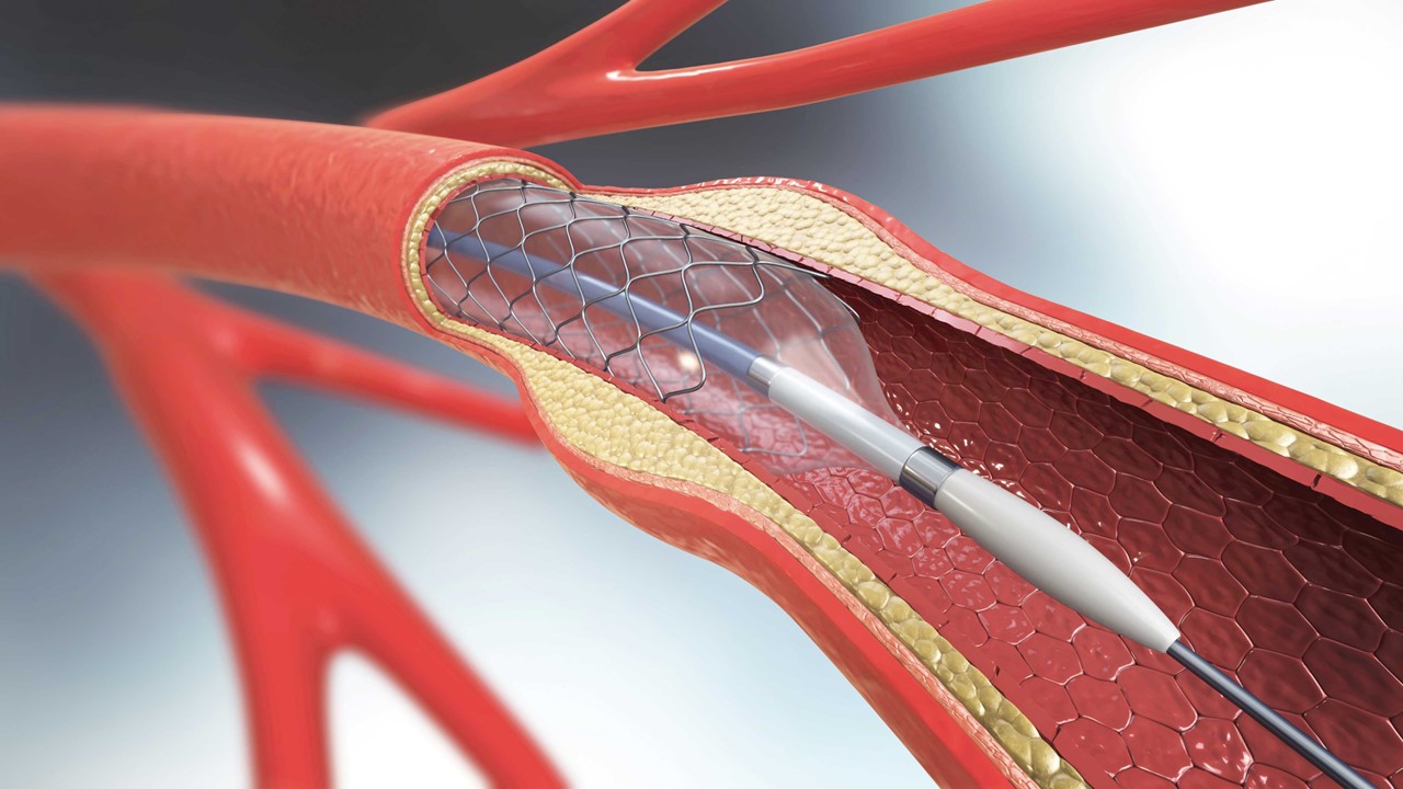 EO-M-026 – Special Flux for Nickel and Nitinol EO-M-026 – Special Flux for Nickel and Nitinol